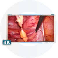 CM-CINEMED – Monitores de Grau Médico para Videocirurgia - Confiance Medical