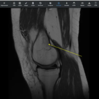 PACS - Sistema de gestão de imagens e exames médicos.
