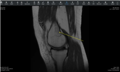 PACS - Sistema de gestão de imagens e exames médicos.